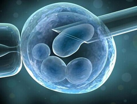 专家